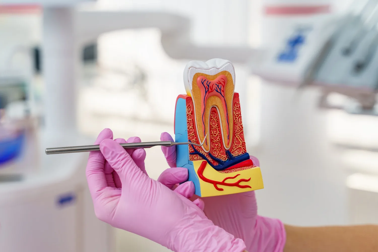 Endodoncia