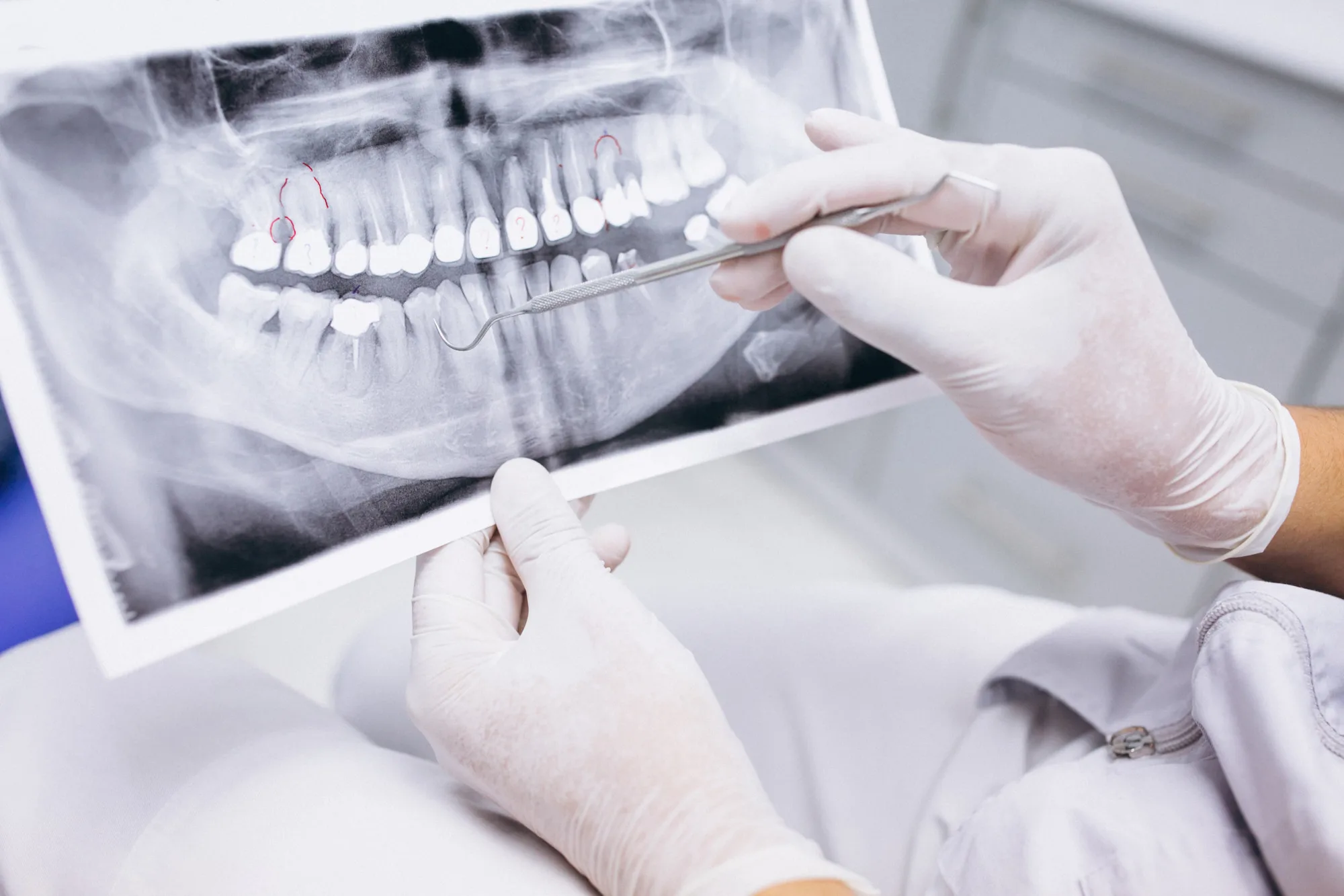Rehabilitación oral